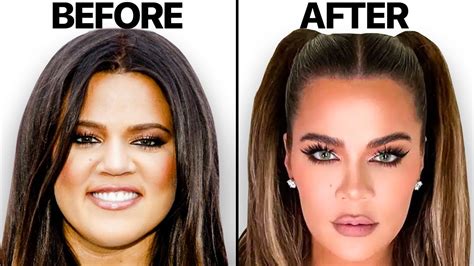 khloe kardashian new face